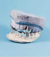 A set of silver teeth